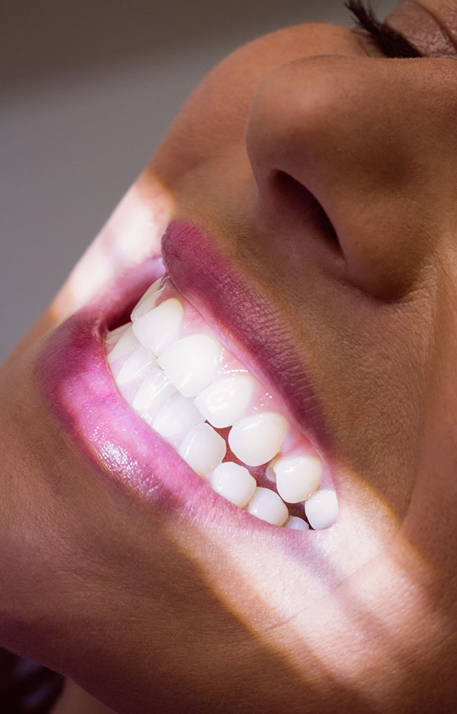 sonrisa blanca