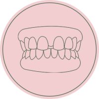 Diastema
